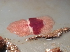 Notoplana sanguinea