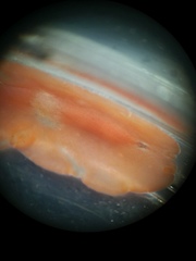 Eurylepta aurantiaca