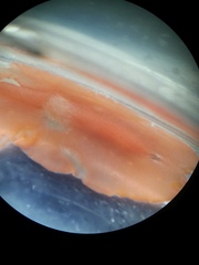 Eurylepta aurantiaca
