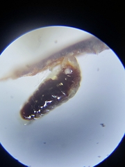 Ectoedemia platanella
