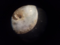Vitrea crystallina
