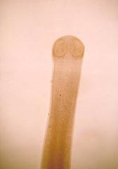 Rat Tapeworm
