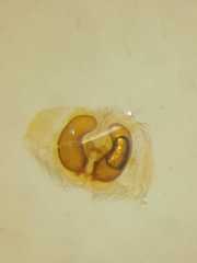 Micythus rangunensis