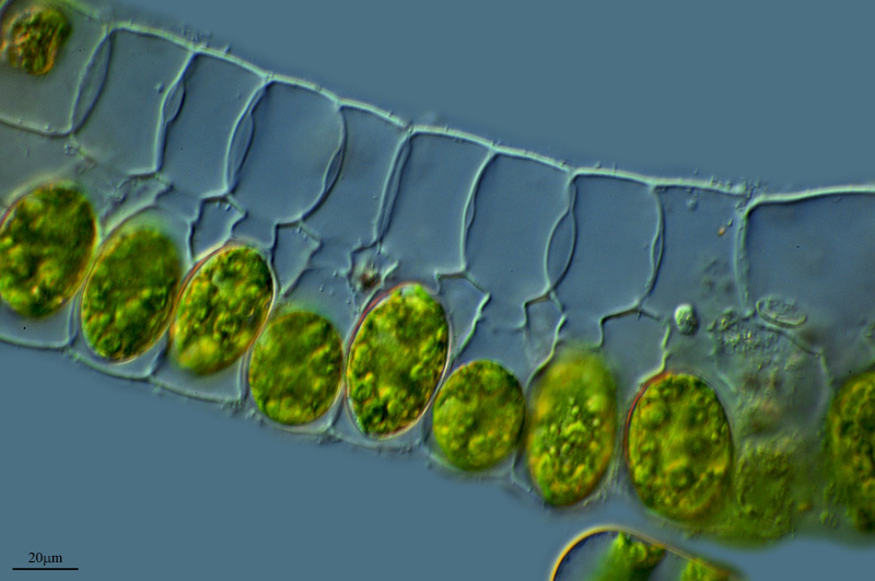 Zygnematales