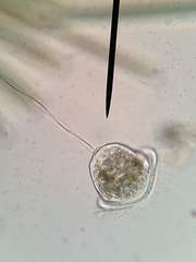 Vorticella campanula