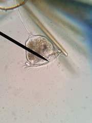 Vorticella campanula