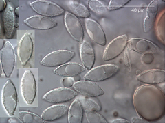 Tarzetta jafneospora