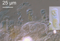 Taphrina sadebeckii