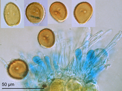 Puccinia unciniarum