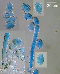 Podosphaera mors-uvae