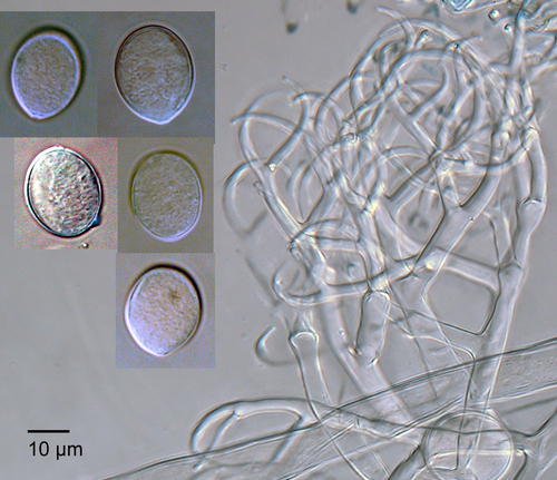 Míldio (Peronospora parasitica)