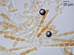 Podosphaera pruni-avium