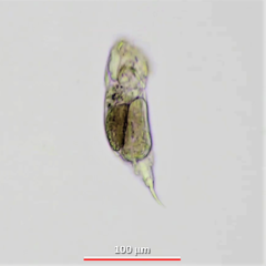 Cephalodella megalocephala