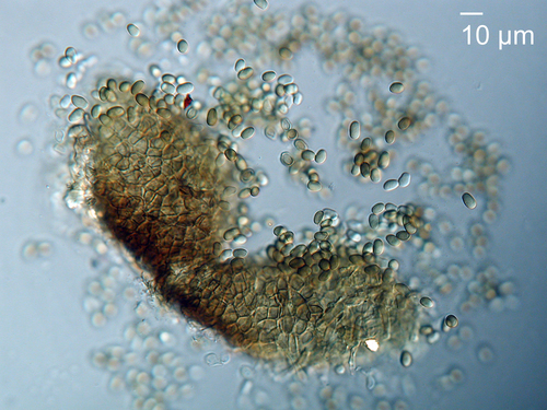 Representative image of Didymellaceae