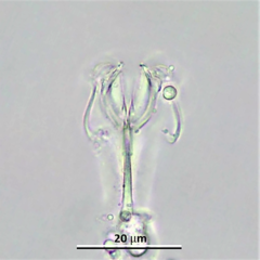 Cephalodella megalocephala