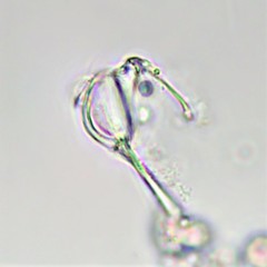 Cephalodella megalocephala