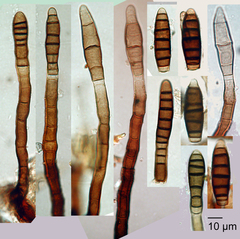 Endophragmiella valdiviana