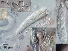 Neofusicoccum australe
