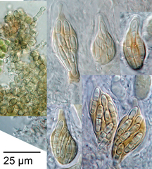Cladosporium herbarum