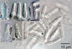 Cladosporium herbarum