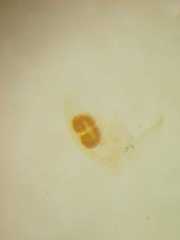 Spilosynema