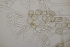 Peronospora
