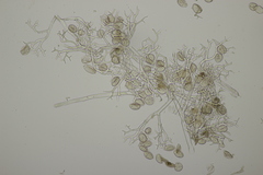 Peronospora