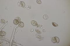 Peronospora