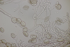 Peronospora