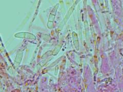 Mitrula lunulatospora