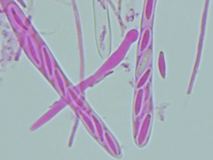 Mitrula lunulatospora