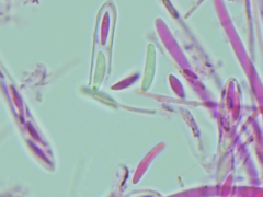 Mitrula lunulatospora