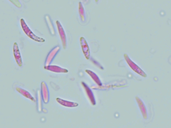 Mitrula lunulatospora