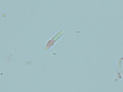 Mitrula lunulatospora