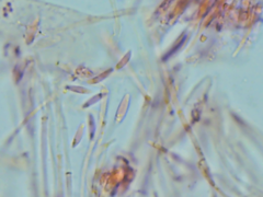 Mitrula lunulatospora