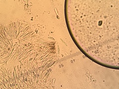 Durella macrospora