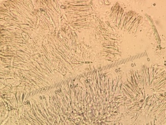 Durella macrospora