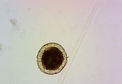 Actinosphaerium