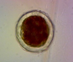 Actinosphaerium