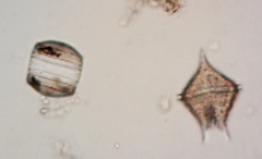 Protoperidinium