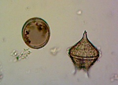 Protoperidinium
