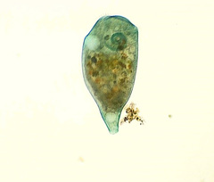 Stentor coeruleus