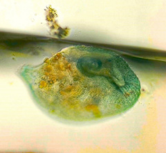 Stentor coeruleus