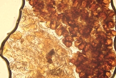 Bartheletia paradoxa