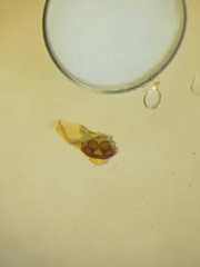 Chorizopesoides wulingensis