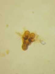 Bijoaraneus postilena