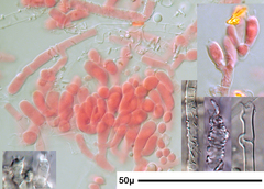 Athelia epiphylla