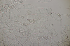 Mastigosporium album