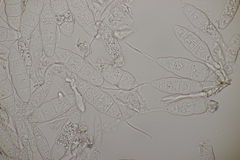 Mastigosporium album