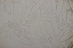 Mastigosporium album